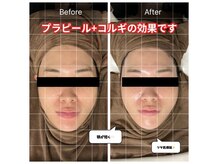 立川初最新プラピール+オーナー独自開発OPで最大限効果を発揮!!