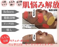 ティパニボーテ(Tipani Beaute')