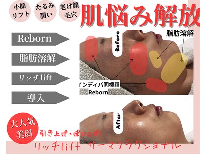 ティパニボーテ(Tipani Beaute')の写真