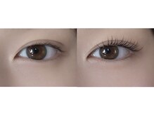 コルザ(colza)の雰囲気（お顔に合うデザインを提供）