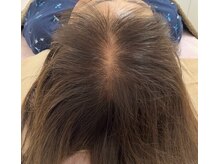 カブール 町田/頭頂部のボリュームダウンも