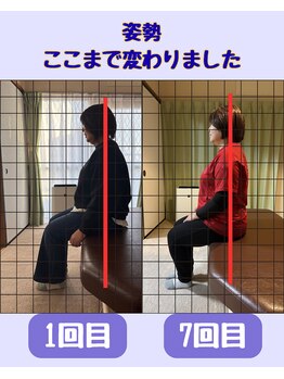 たくあん鍼灸院の写真/【猫背と巻き肩、そのまま放置していませんか？】体の歪みを整えて、3か月で変わる軽い体と美しい姿勢へ