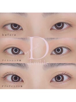 ブランジュ(Blange)/ダブルアイリフト