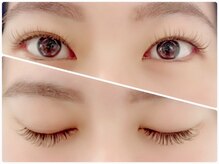 エターナルアイ(Eternal Eye)