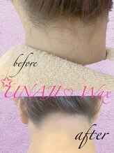 アエラ(AERA)/【ワックス脱毛】うなじ