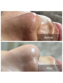 リノリー(rinory)/肌管理