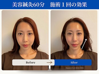 和らの写真
