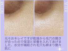 リラクゼーションサロン ラキ(laki)/スキンメイド/トロイアルケ