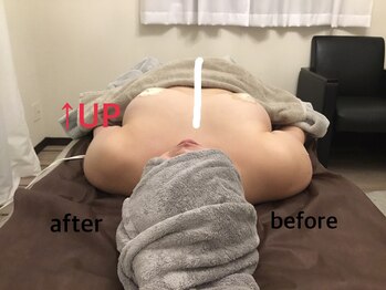 サロン ワン(salon one)/before after