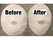 美極 トータルビューティー(美極 TOTAL BEAUTY)/恵比寿/小顔コルギ/エステ/