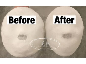 美極 トータルビューティー(美極 TOTAL BEAUTY)/恵比寿/小顔コルギ/エステ/