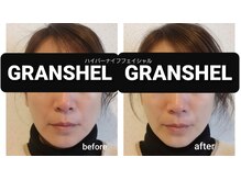 グランシェル(GRANSHEL)/