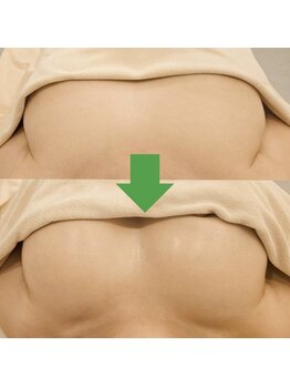 ホットナンバー(HOT number)/美容液ジェルと高品質オイルで