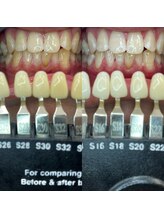 トウキョースワーズ 渋谷店(TOKYO SWRS)/#ホワイトニング #渋谷 #池袋
