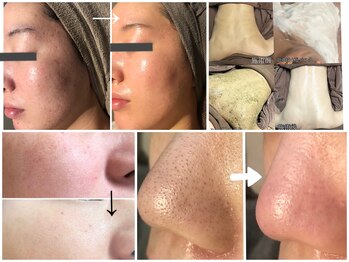 セリンダ(selinda)