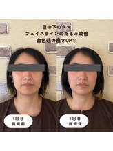 ウーマンビーヘルス(woman Be Health)/オーダーメイド美容鍼灸90分1回