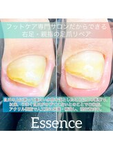 エッセンス (Essence)/トラブル爪のための自爪育成