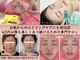 アンリエッタ(Unlieta)の写真