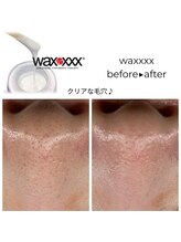 ロア ビューテ(loa beaut'e)/waxxxx before→after