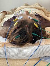 マナ鍼灸院(MANA鍼灸院)/美容鍼×頭皮鍼