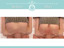 美人バスト つくば店/【バストアップ/症例　育乳】