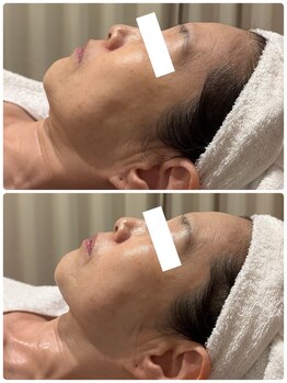 エヴォリス(EVOLIS)の写真/本気で変わりたい人のノーファンデ肌へ◇その場しのぎではなく原因から改善！通うたび変化を実感♪