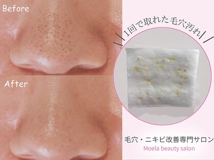 モエラビューティーサロン(Moela beauty salon)の写真