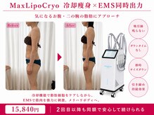 オリエンタルローザ 表参道(Oriental Rosa)/一度で二の腕&お腹を同時にケア