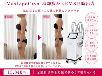 オリエンタルローザ 表参道(Oriental Rosa)/一度で二の腕&お腹を同時にケア