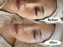 シーン(Sheen)/くすみや赤みが一掃