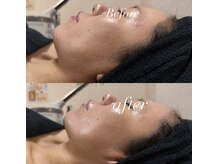 マヤヒメ(mayahime)/輪郭すっきりプルプル肌