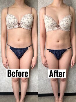 ノート(Naught)/大好評☆育乳バストケアメニュー