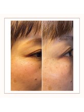 アミュレット(amulette)/インディバフェイシャル