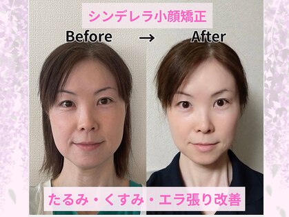 ラ キュート(LA-9TE)の写真