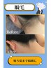 ●脱毛●【アップヘアが映えるつるん肌】うなじ脱毛¥2,200