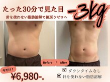 ソルニス(Solnis.)