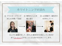 ホワイトニングショップ 徳島店/セルフホワイトニング
