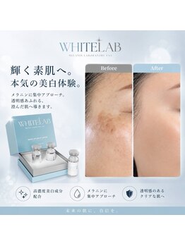 ネイビー(NAVY)の写真/今話題の韓国発シミケア☆レーザーを使わないホワイトラボで７日間で気になるシミから卒業♪