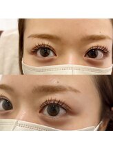 シーディーエム(cdm)/&ヘルシー(マツエク＋パーマ)