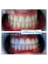 シフォン 豊田店/3週間フリーパス終了のお客様