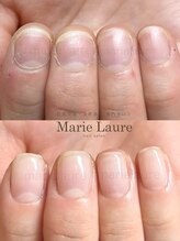 マリーロール 淀屋橋本店(Marie Laure)/自爪育成/深爪矯正/ネイルケア