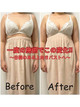 クオーレ(Cuore)/上向きふんわりバスト作れます！