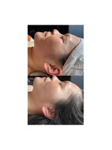 アディクト(Addict)/Before＆After