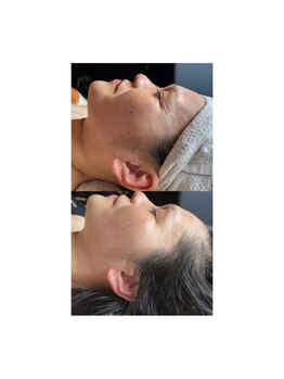 アディクト(Addict)/Before＆After