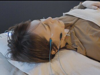 ラメール 京丹後(la mer)の写真/《大人女性必見》ほうれい線・たるみ・シワ改善☆美容鍼でフェイスラインすっきり！美容鍼は予防にも最適◎