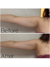 カシェボーテ(CACHE BEAUTE)/