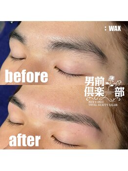男前倶楽部/脱毛/メンズ脱毛/メンズ専門店
