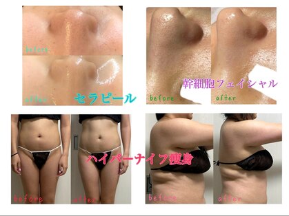 ピクシー(pixie)の写真