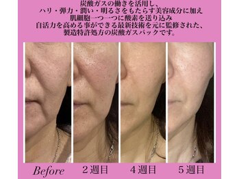 フェミニー(Feminy)/大人気商品です