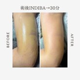 インディバ アンド ルヴィ 沖縄店(INDIBA&REVI)